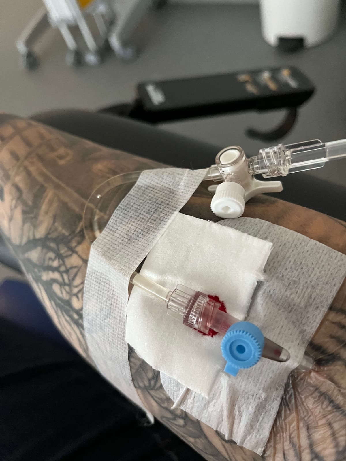 Tag X – Ein Schritt weiter, zwei Stiche mehr und ein kleiner Stolperer